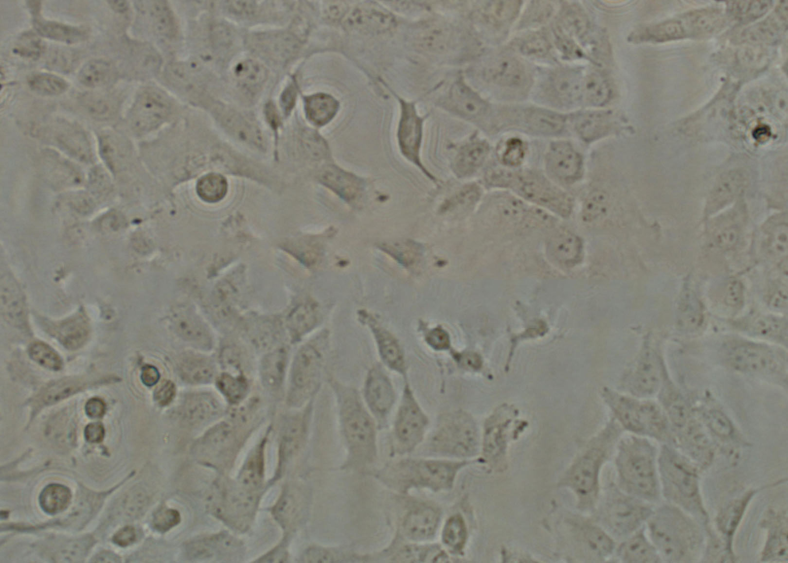 ST2 Cell|小鼠骨髓基质细胞,ST2 Cell