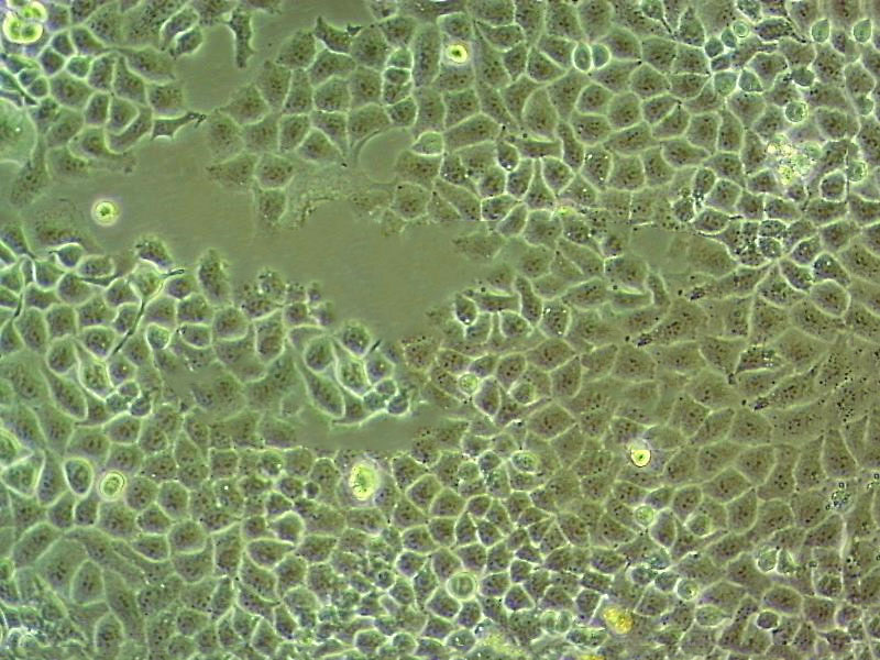 GC9811-P Cell|人胃癌腹膜高转移细胞,GC9811-P Cell