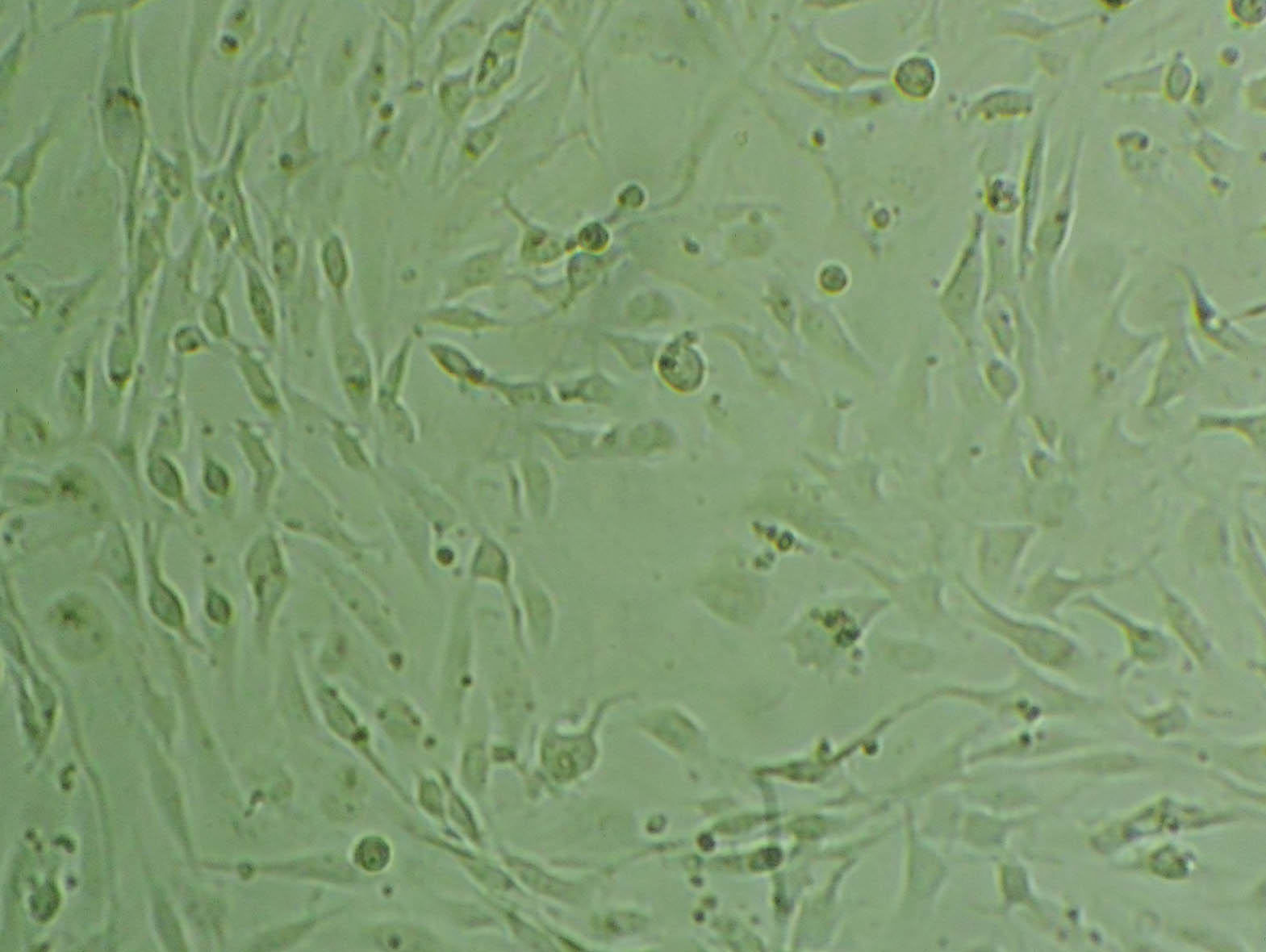 B104 [Rat neuroblastoma] Cell|大鼠神经母细胞瘤细胞,B104 [Rat neuroblastoma] Cell