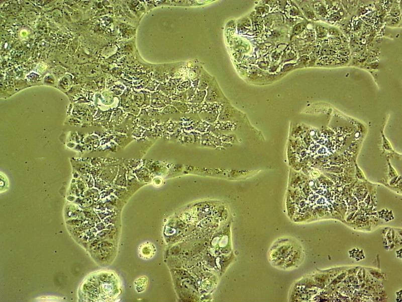 LTEP-sm Cell|人小细胞肺癌细胞,LTEP-sm Cell