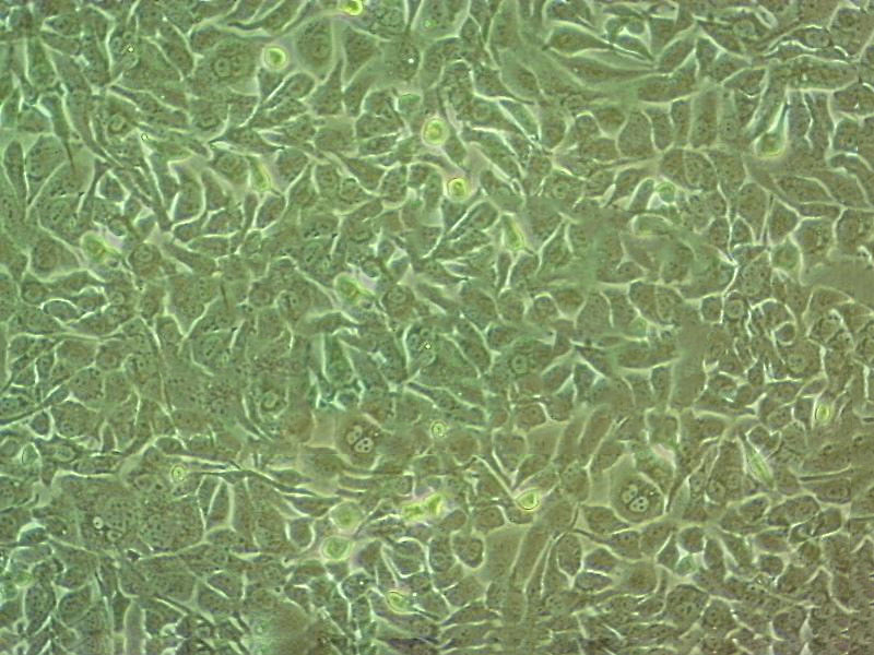 EBC-1 Cell|人肺鳞癌细胞,EBC-1 Cell
