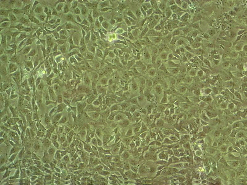 MDA231-LM2-4175 Cell|人高转移性乳腺癌细胞,MDA231-LM2-4175 Cell