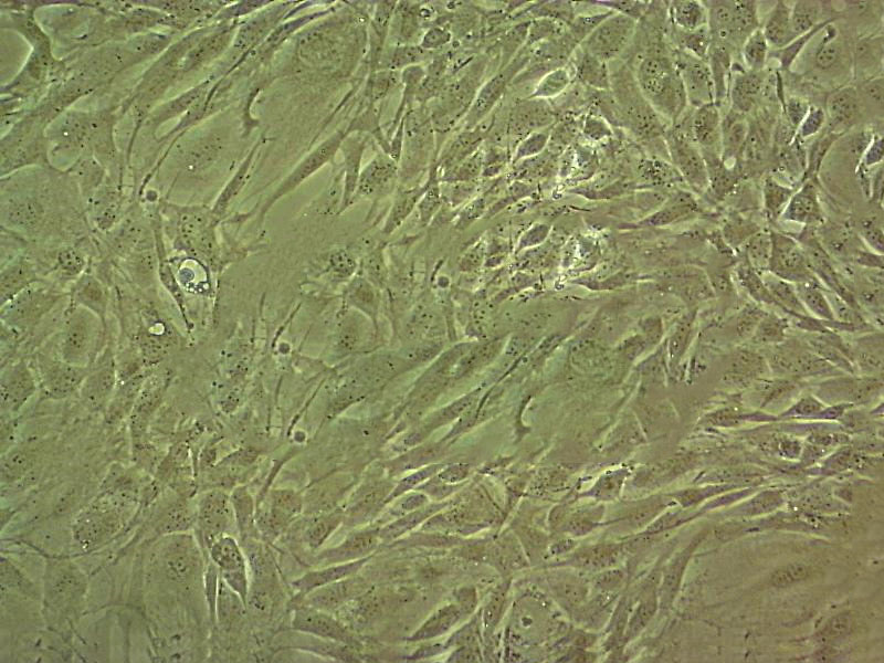 HCC2185 Cell|人乳腺转移性小叶癌细胞,HCC2185 Cell