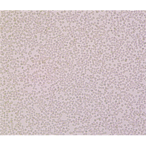 6T-CEM（人T细胞白血病细胞）
