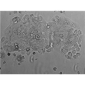 WiDr Cell|人结直肠癌细胞