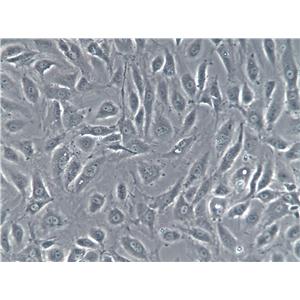 MH-S Cell|小鼠肺泡巨噬细胞