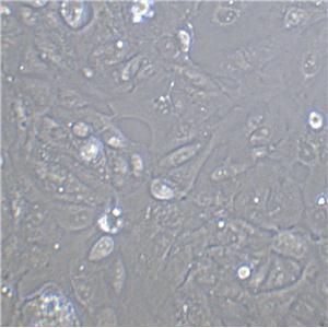 SUM149PT Cell|人乳腺癌细胞