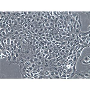 MBT-2 Cell|小鼠膀胱癌细胞,MBT-2 Cell