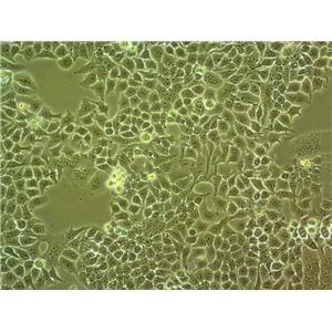 SG231 Cell|人胆管上皮癌细胞