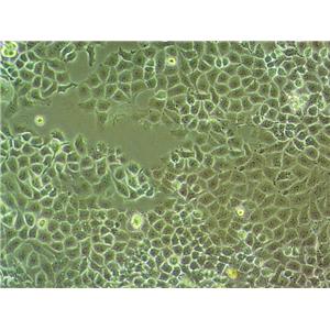 GC9811-P Cell|人胃癌腹膜高转移细胞