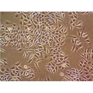 B35 Cell|大鼠神经母细胞瘤细胞