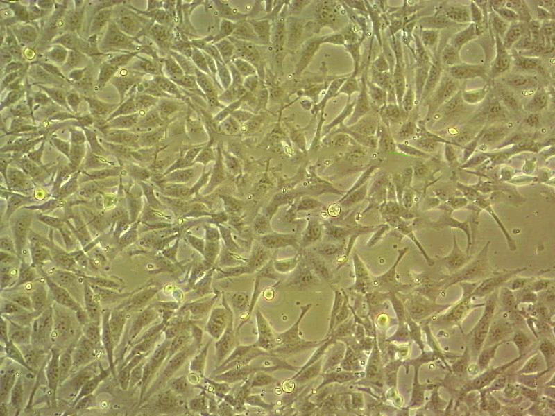 SLK Cell|卡波西肉瘤细胞,SLK Cell