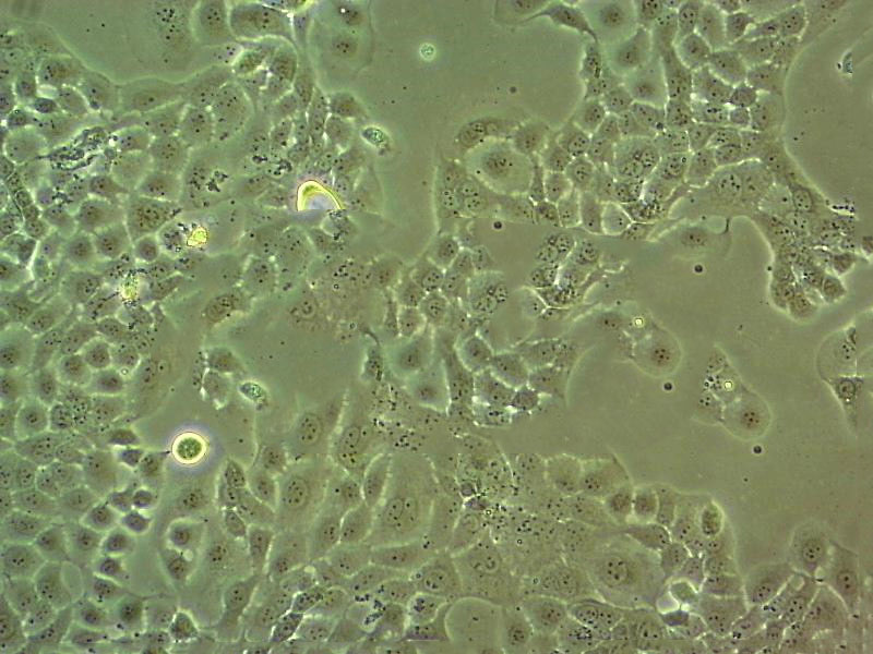 HNE-1 Cell|人鼻咽癌细胞,HNE-1 Cell