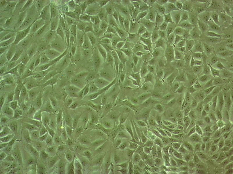 Hca-F Cell|小鼠肝癌细胞,Hca-F Cell