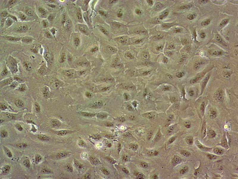 EO771 Cell|小鼠髓样乳腺癌细胞,EO771 Cell