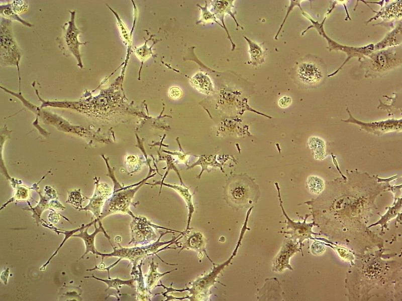 NCI-H128 Cell|人小细胞肺癌细胞,NCI-H128 Cell