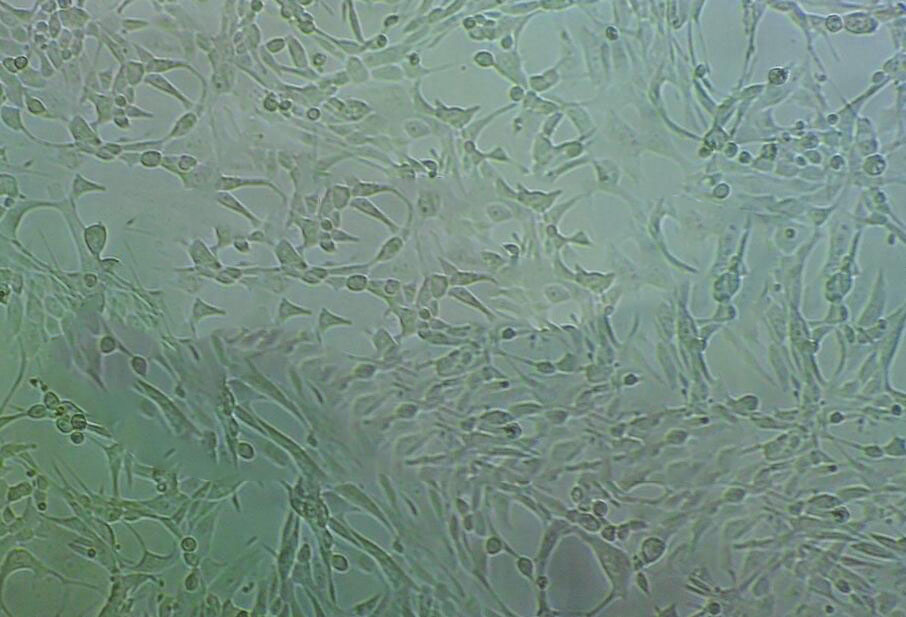 67NR Cell|小鼠乳腺癌细胞,67NR Cell