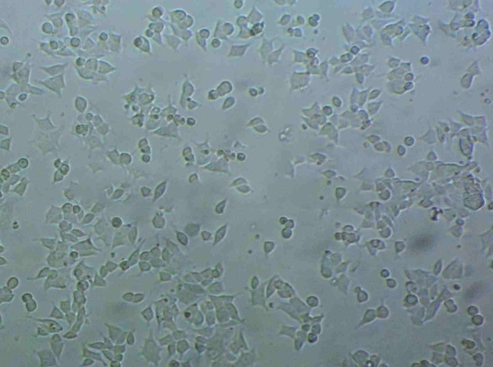 NRCC Cell|人肾透明细胞癌细胞,NRCC Cell