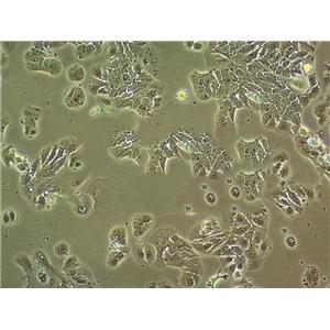 SNU-11SNU-119 Cell|人卵巢癌细胞9 Cell|人卵巢癌细胞