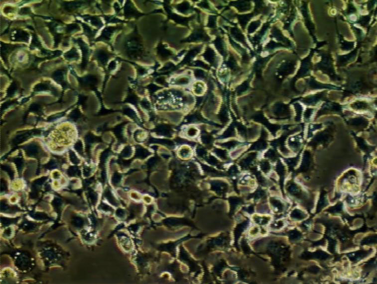 MM96L Cell|人黑色素瘤细胞,MM96L Cell