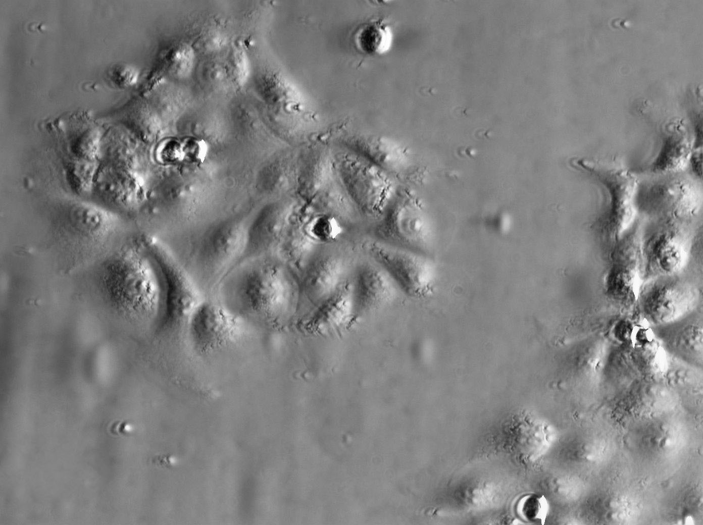 CL1-0 Cell|人肺腺癌细胞,CL1-0 Cell