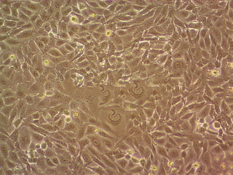 MuM-2B Cell|人眼脉络黑色素瘤细胞,MuM-2B Cell