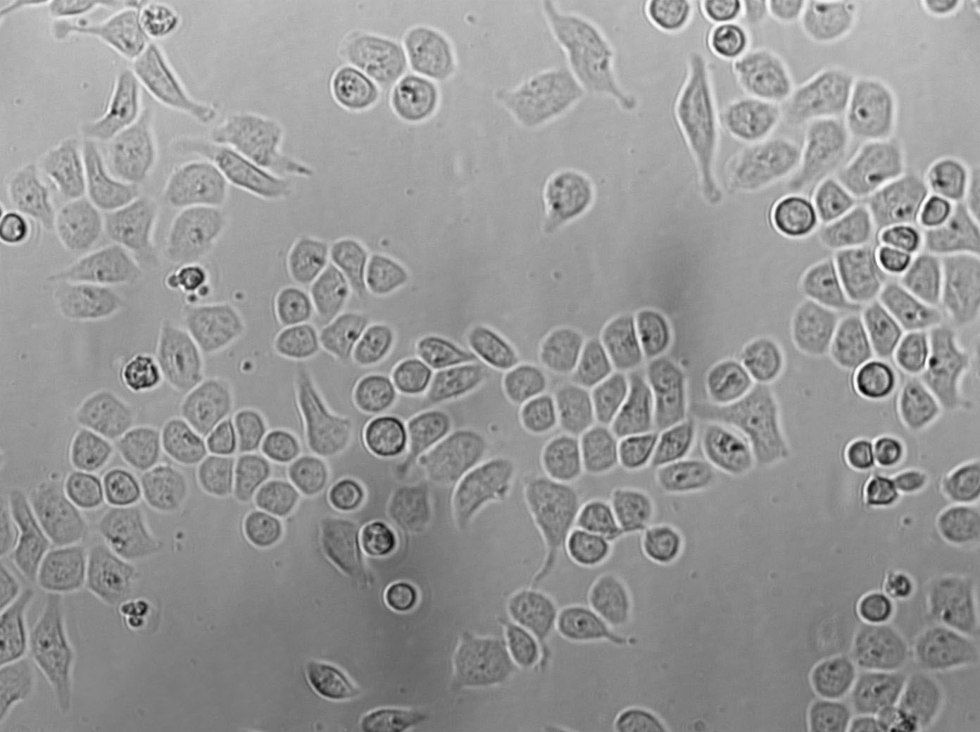 Tu 177 Cell|人喉鳞癌细胞,Tu 177 Cell