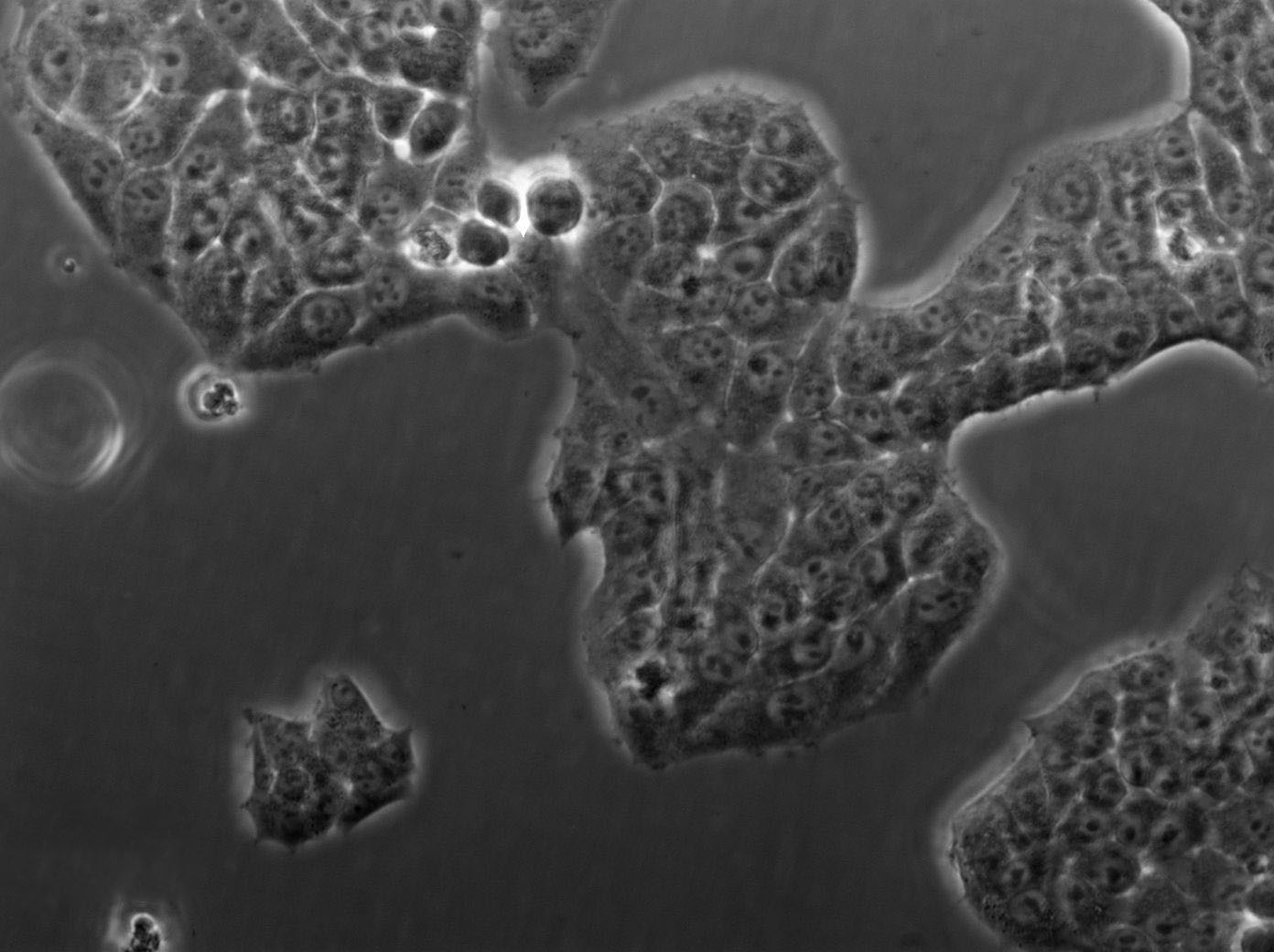 NCI-H719 Cell|人小细胞肺癌细胞,NCI-H719 Cell