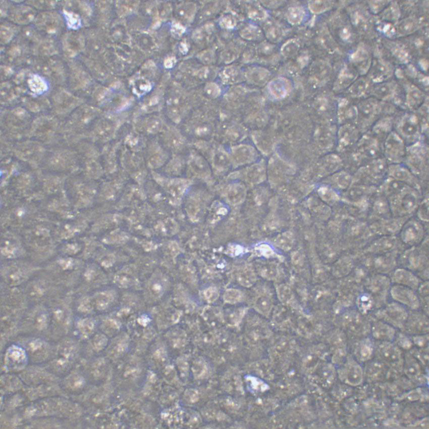 OVCAR-5 Cell|人卵巢癌细胞,OVCAR-5 Cell