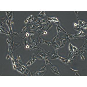 CSQT-2 Cell|人肝癌细胞