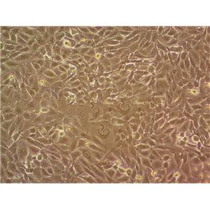 MuM-2B Cell|人眼脉络黑色素瘤细胞