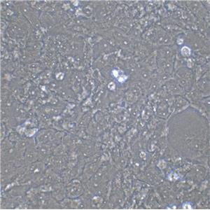 OVTOKO Cell|人卵巢透明细胞癌细胞,OVTOKO Cell