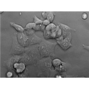 NCI-H125 Cell|人非小细胞肺癌细胞