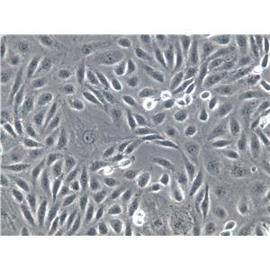 Ca759 Cell|小鼠乳腺癌细胞,Ca759 Cell