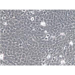 BHT101 Cell|人甲状腺癌细胞,BHT101 Cell