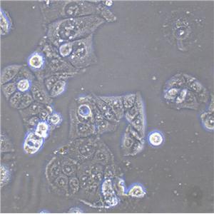 MUG-Chor1 Cell|人骶骨脊索瘤细胞