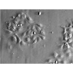 ACC-M Cell|人涎腺癌细胞