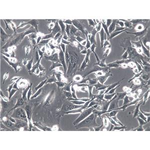 CNE-2Z Cell|人鼻咽癌细胞,CNE-2Z Cell
