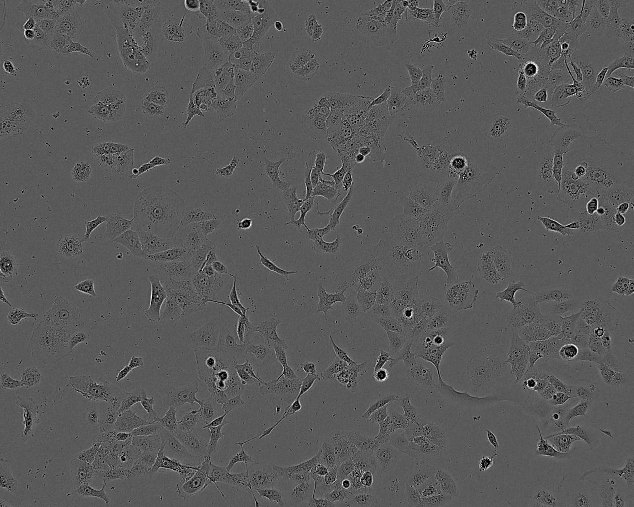 KRC/Y Cell|人肾癌细胞,KRC/Y Cell