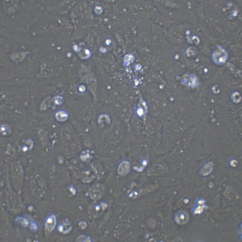 OVCA433 Cell|人卵巢癌细胞,OVCA433 Cell