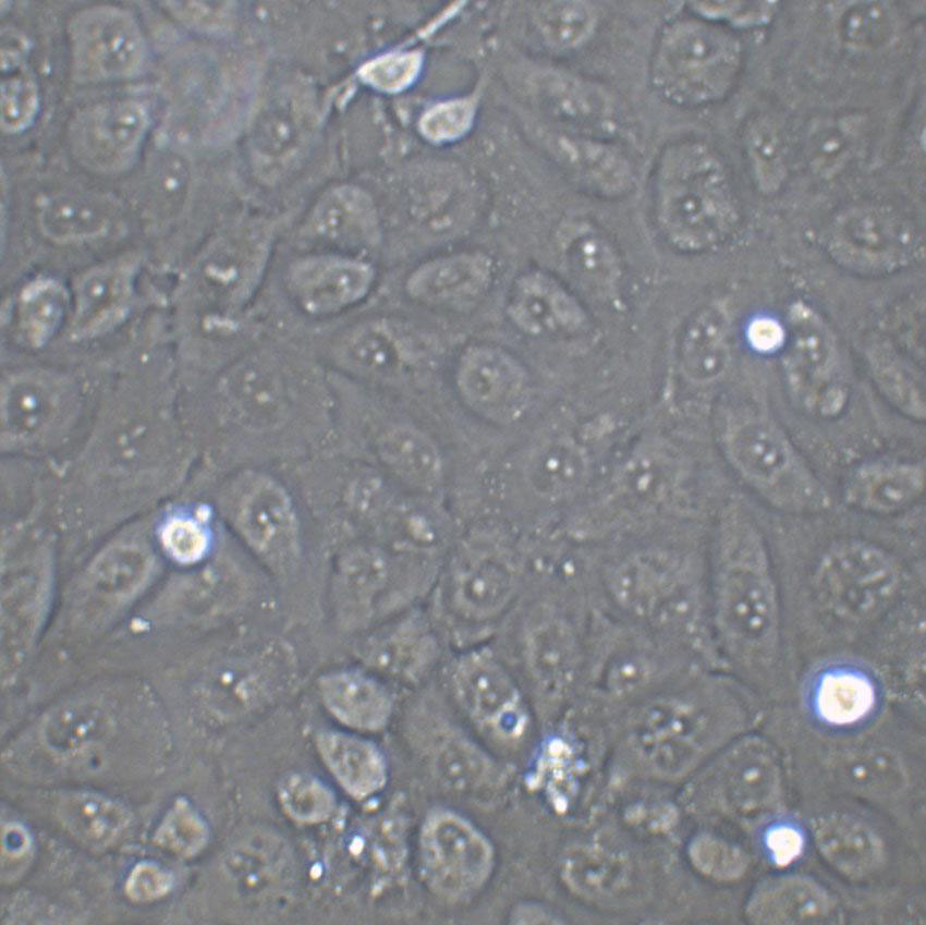 CMT167 Cell|小鼠肺癌细胞,CMT167 Cell