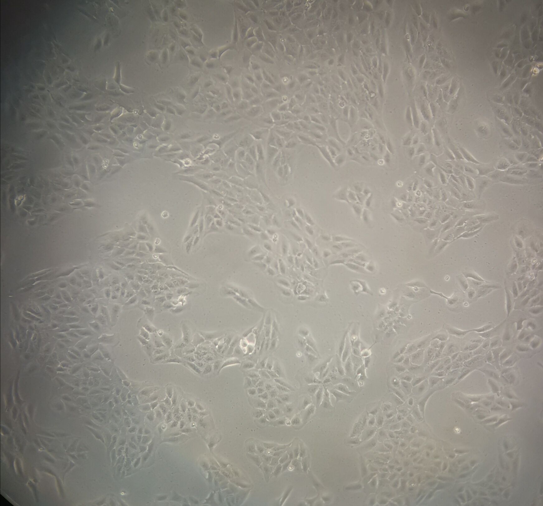 108CC15 Cell|小鼠神经母瘤与大鼠胶质瘤之融合细胞,108CC15 Cell