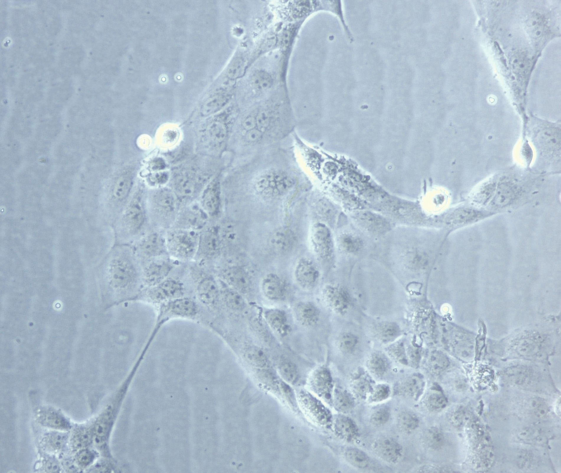 LP-1 Cell|人多发性骨髓瘤白细胞,LP-1 Cell