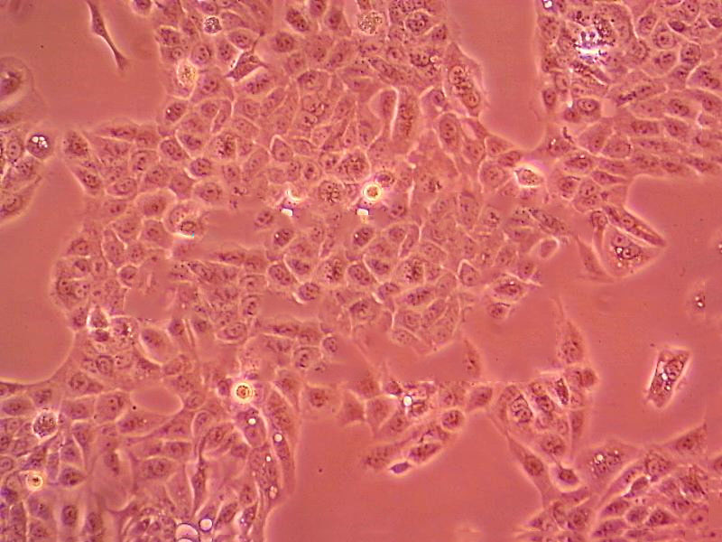 SPC-A1 Cell|人肺腺癌細(xì)胞,SPC-A1 Cell