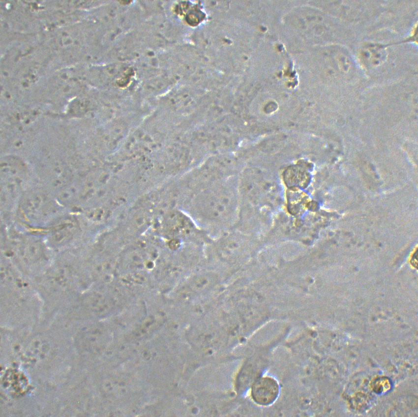 PG-LH7 Cell|人肺癌低转移细胞,PG-LH7 Cell