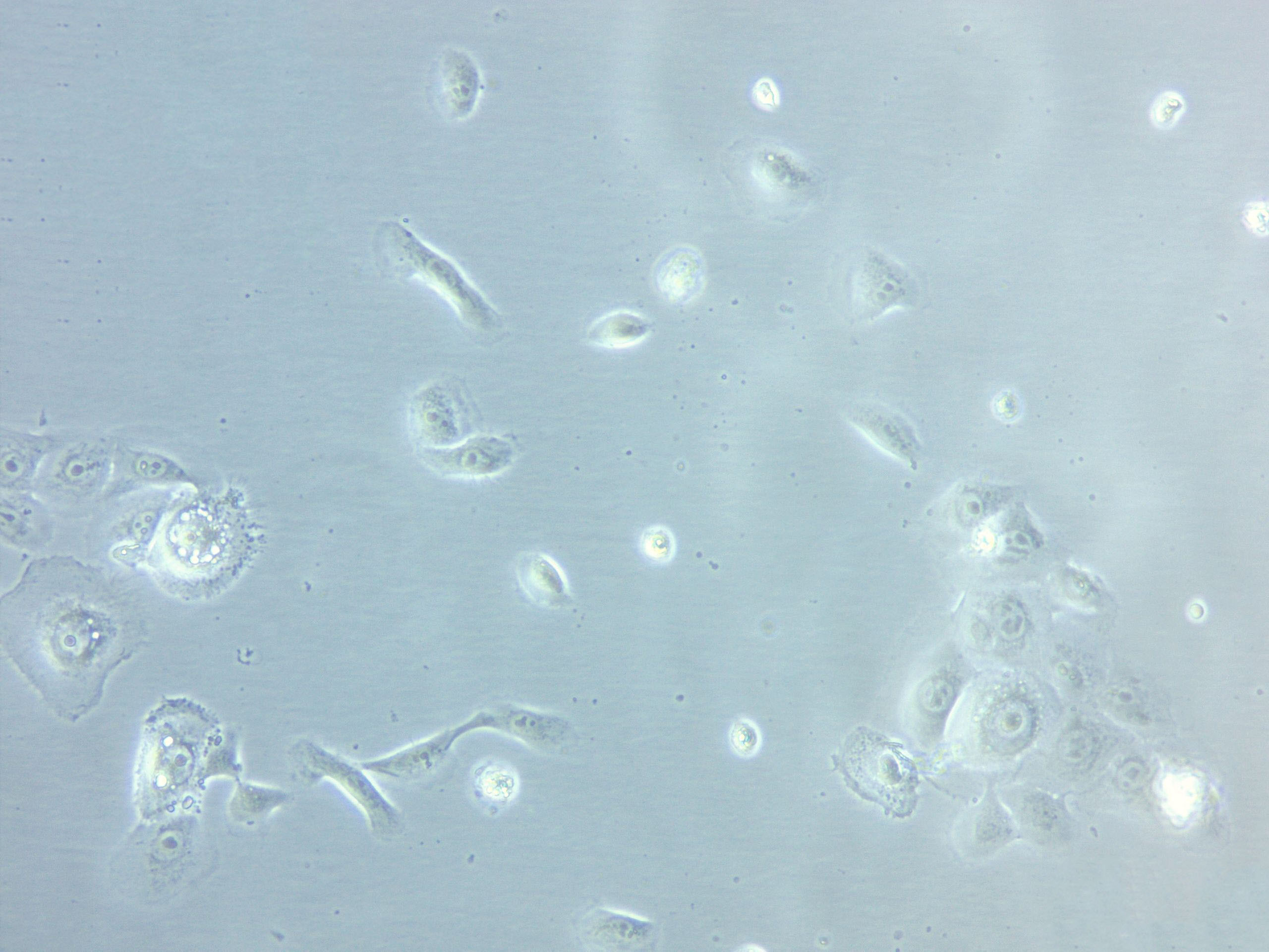 CBRH-7919 Cell|大鼠肝癌细胞,CBRH-7919 Cell