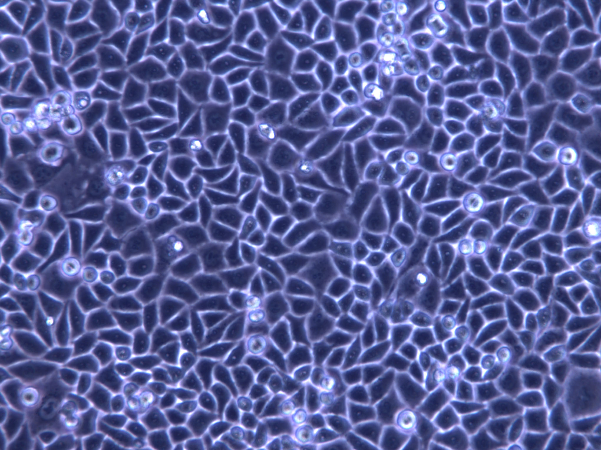 QG-56 Cell|人肺扁平上皮癌细胞,QG-56 Cell