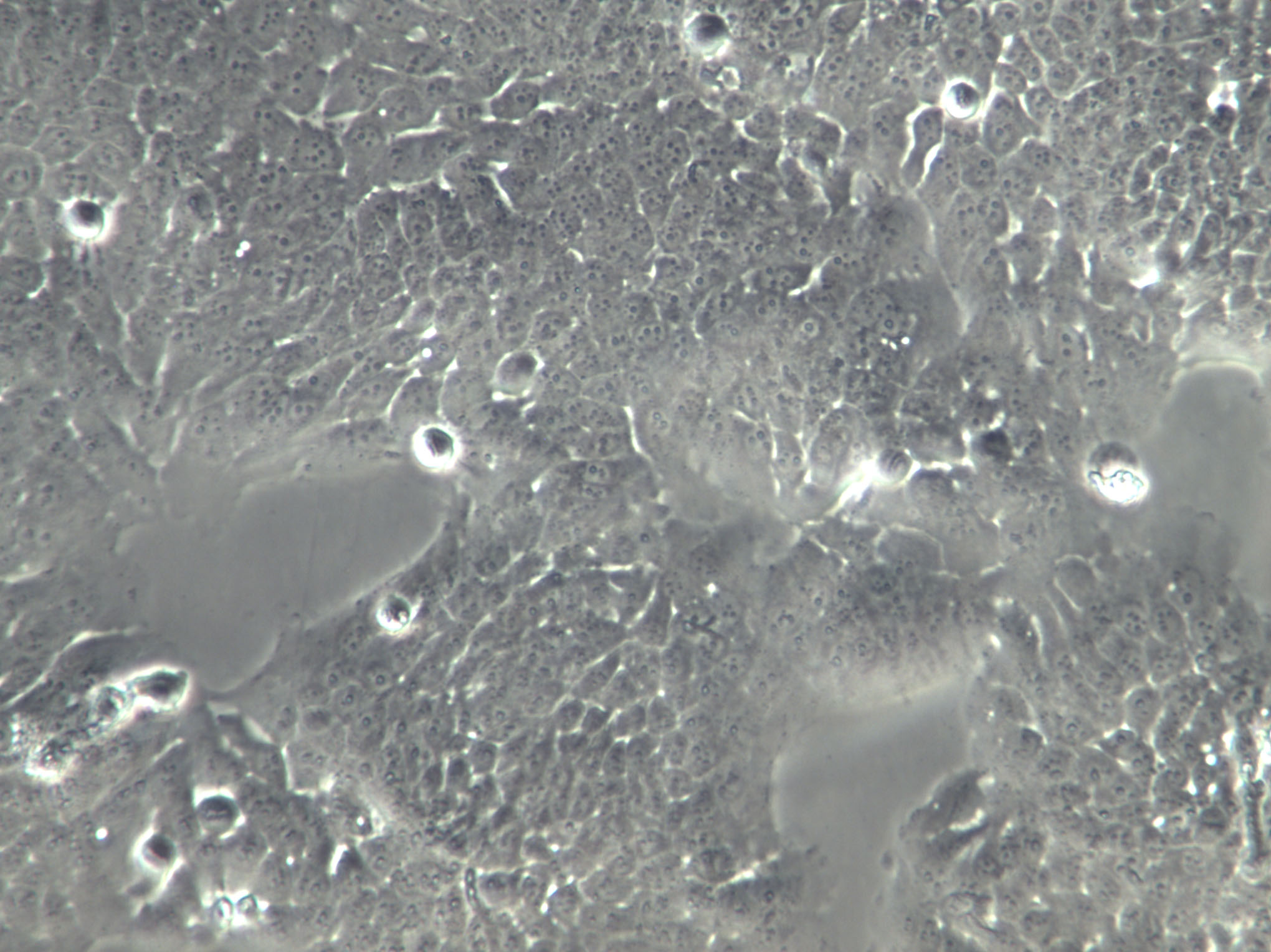 SL1 Cell|人胚肺转化细胞,SL1 Cell