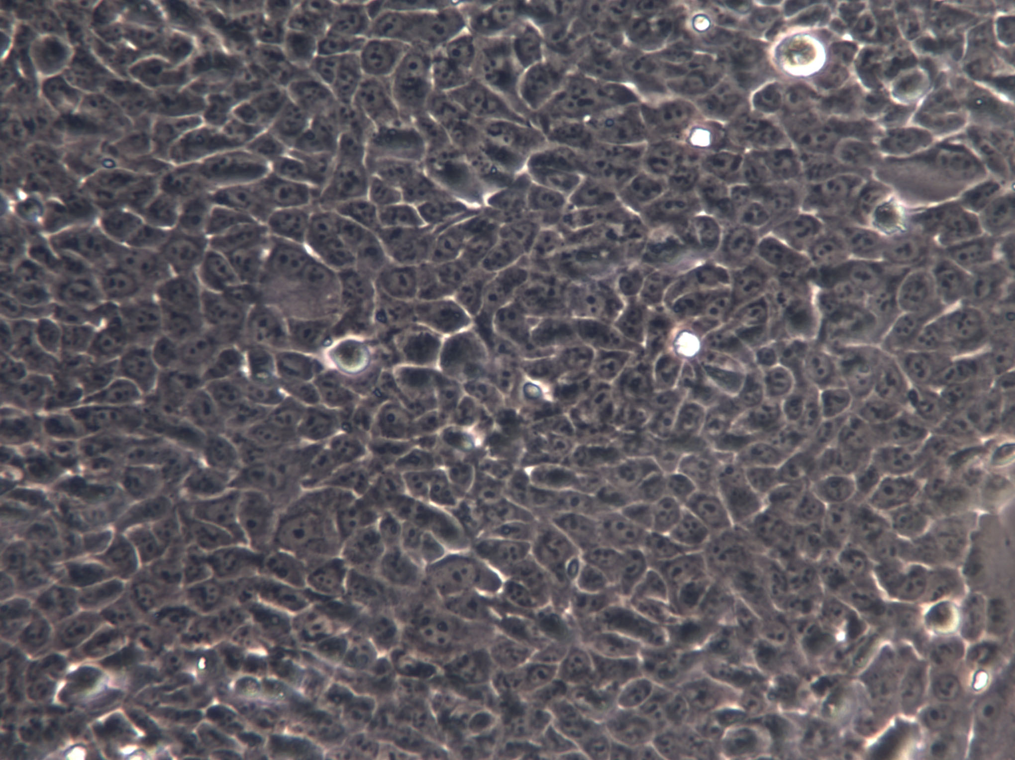 RIN-m Cell|褐鼠胰岛素瘤上皮细胞,RIN-m Cell