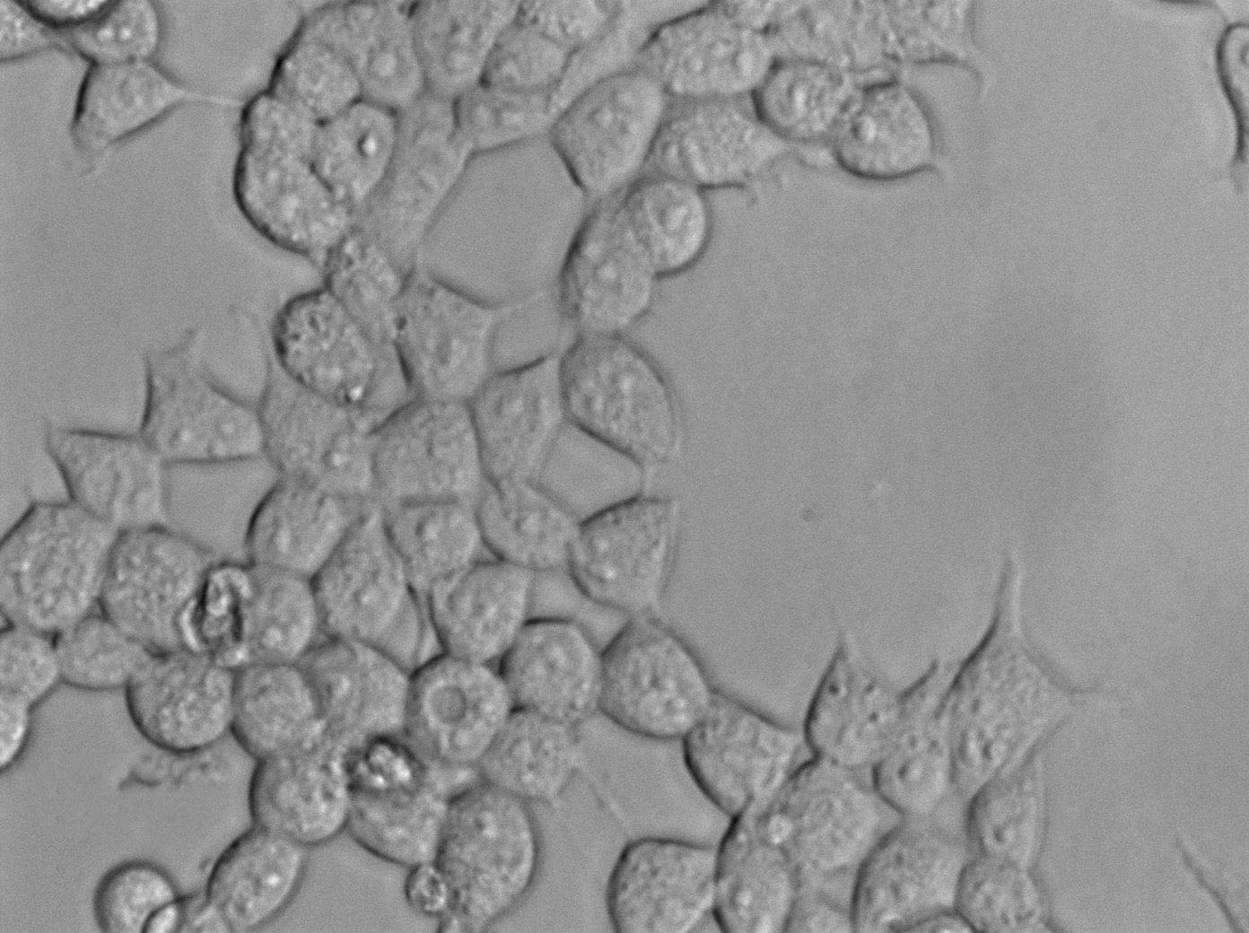 HEC-151 Cell|人子宫内膜癌细胞,HEC-151 Cell